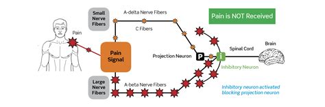 Pain Gate Theory Explained - Design Talk