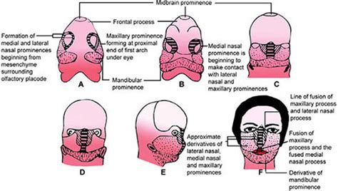 Maxillary Process Embryology