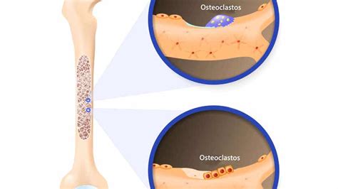 Osteogénesis: la formación de los huesos - Mejor con Salud