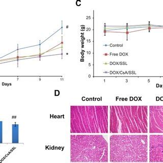 characterization of the sterically stabilized liposomes co-loaded with... | Download Scientific ...