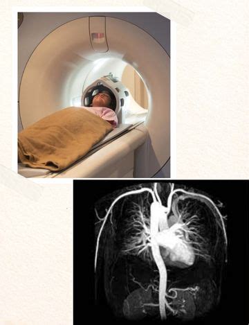 Mri Scan Cost in hyderabad for Angiogram @4599 | Medintu