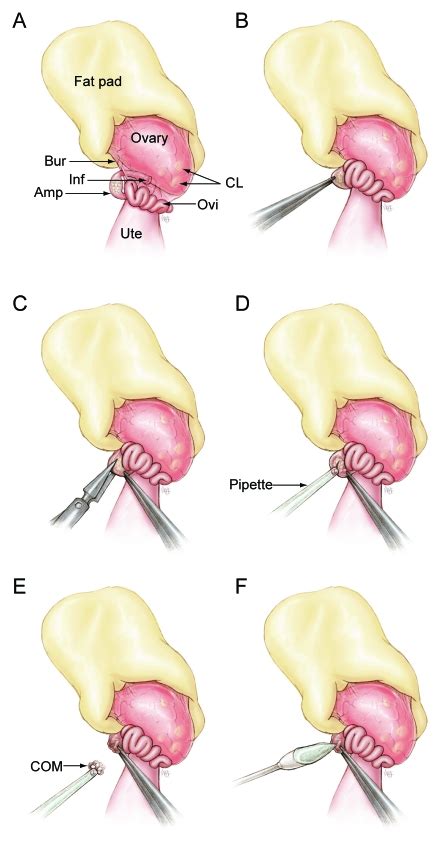 Surgical oocyte retrieval (SOR): a method for collecting mature mouse oocytes without euthanasia ...