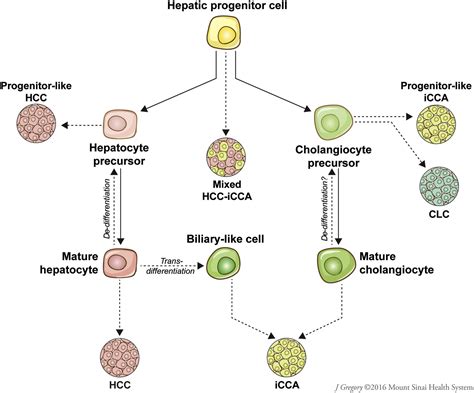 What are the Different Types of Liver Cancer, and How do They Develop? | AGA Journals Blog