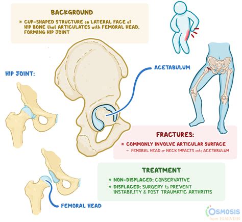 Acetabulum: What Is It, Function, Fractures, and More | Osmosis