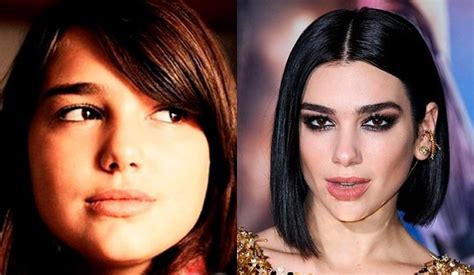 Dua Lipa Before and After Plastic Surgery: Nose, Lips, Face