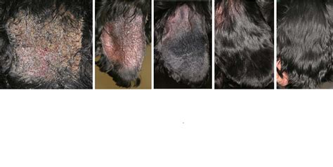 Pemphigus Foliaceus - The Skin Vet