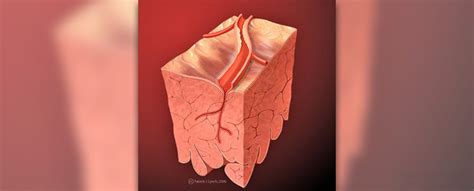 Carotid artery blockage treatment | General center | SteadyHealth.com