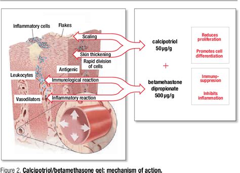 Figure 2 from Making Education Easy 2016 Daivobet ® ( Calcipotriol / Betamethasone Dipropionate ...