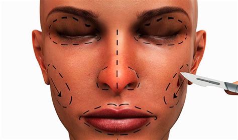 plastic surgery markings face - Google Search | Photography projects, Face, Plastic surgery