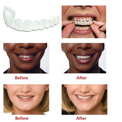 Teeth Whitening Snap On Smile Teeth Cosmetic Denture Instant Perfect Smile Teeth Fake Tooth ...