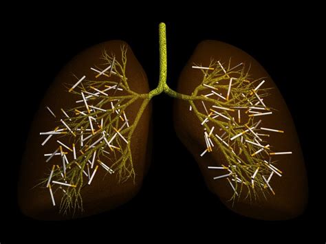 As an Ex-Smoker, Am I at Risk for Lung Cancer? | Meshpedia