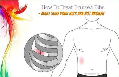 17 Tips How To Treat Bruised Ribs From A Fall Or Coughing Fast