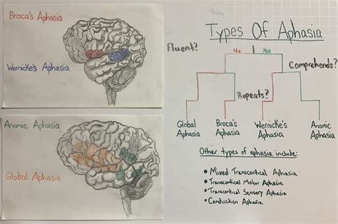 Types of Aphasia and What is Affected – Human STEAM