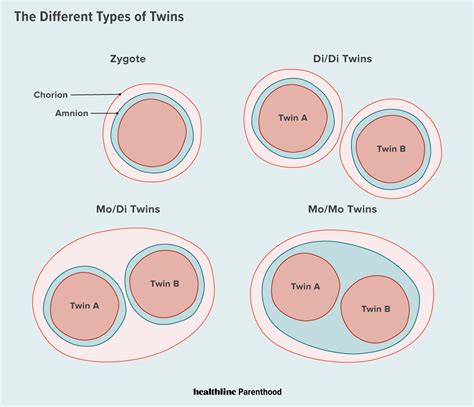 Di/Di Twins: Definition, Risks, and More