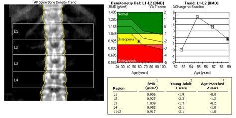 CP Advanced Imaging | Bone Densitometry