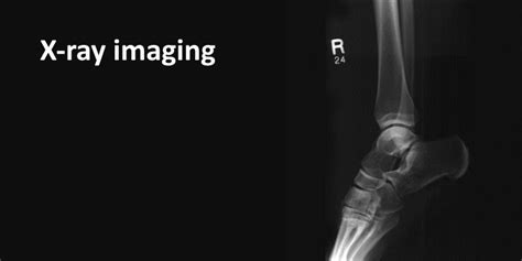 X-ray Imaging - SLT info