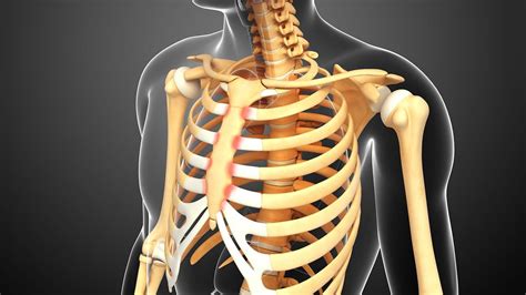 Polyarthrite rhumatoïde et costochondite : Que faut-il savoir sur les ...