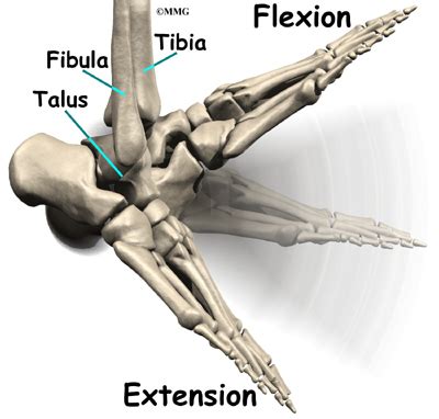 Ankle Fusion | eOrthopod.com