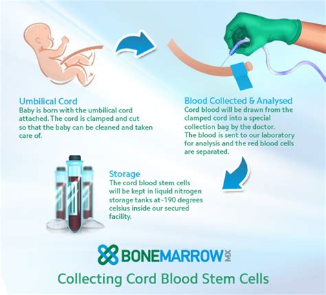 Cord Blood Banking : Why Donate it to protect your family health