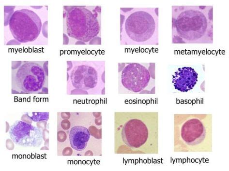 myelocyte metamyelocyte - Google | hematology | Medical laboratory ...