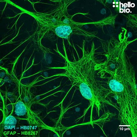 Anti-GFAP antibody ValidAb™ | Astrocyte marker | Mouse Monoclonal | HB8267