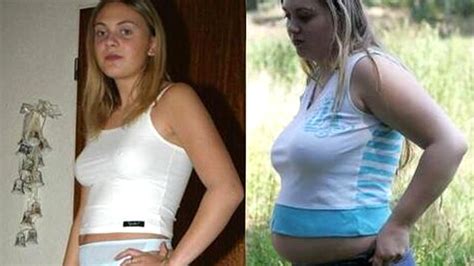 Weight Gain Before And After Girl | www.imgkid.com - The Image Kid Has It!