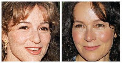 Plastic Surgery Before And After: Jennifer Grey Nose Job