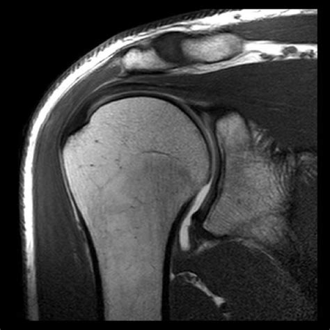 Contract Service MRI - US Occ Docs