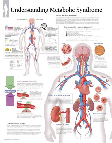 Scientific Publishing Understanding Metabolic Syndrome Chart