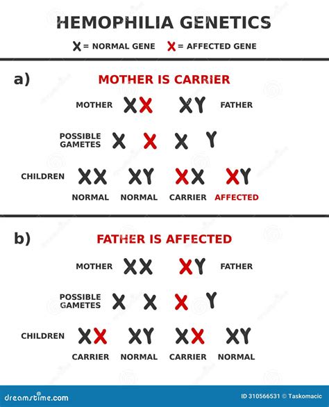 Hemophilia Genetics Infographic. Hemophilia Is An X-linked Recessive Hereditary Disorder ...