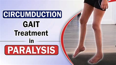 Circumduction Gait