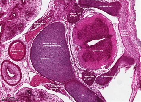 Neural - Spinal Cord Development - Embryology