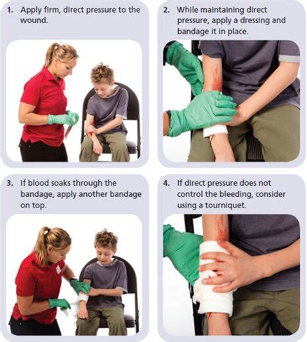 External Bleeding Treatment