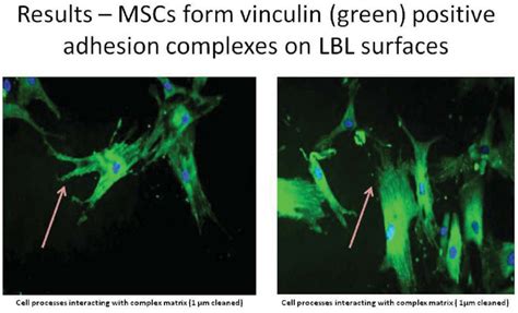 Fluorescent microscopy-Vinculin adhesion complexes. Cells processes... | Download Scientific Diagram