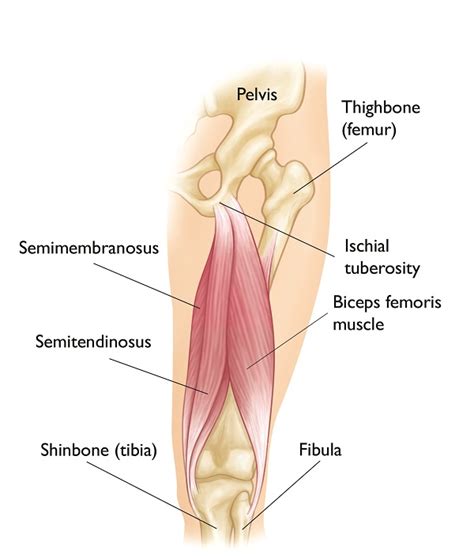 Hamstring Muscle Injuries - OrthoInfo - AAOS