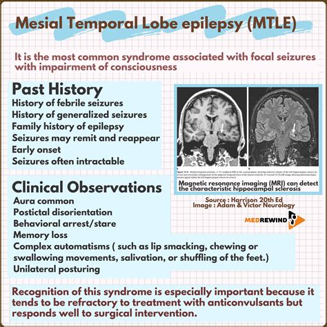 MedRewind - Mesial Temporal Lobe Epilepsy: also known as...