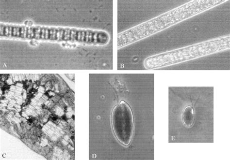 Main oxygenic phototrophs from the DCM of Lake Arcas. (A) Oscillatoria... | Download Scientific ...