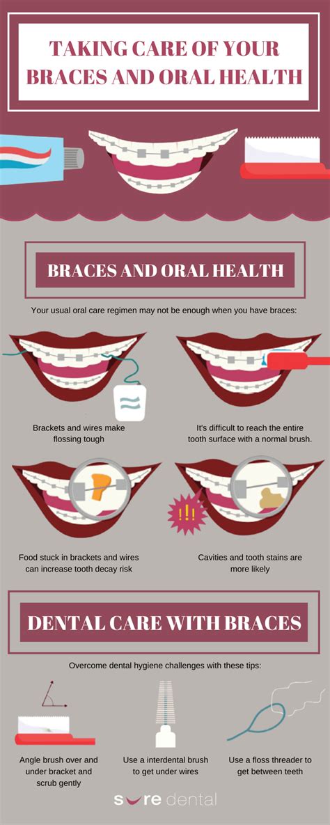 Taking Care of Your Braces and Teeth - Sure Dental