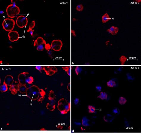 Confocal laser scanning microscopy showing the immunofluorescence (Cy3,... | Download Scientific ...