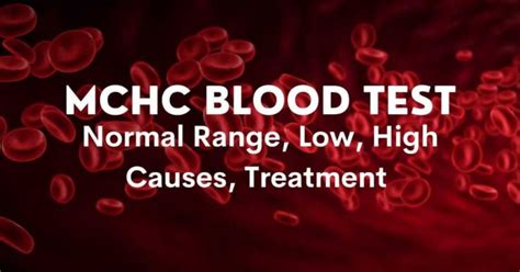 MCH Blood Test: High, Low, Symptoms, Treatments, Complete Details – DoctorOnHealth