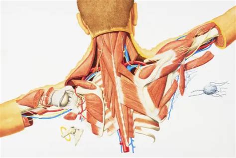 Severe Neck Muscle Pain