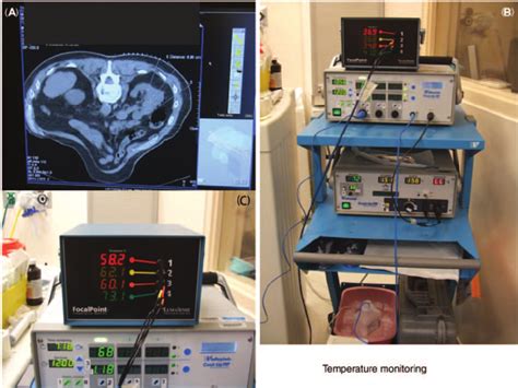 Importance of real-time temperature monitoring. (A) Probe placement ...