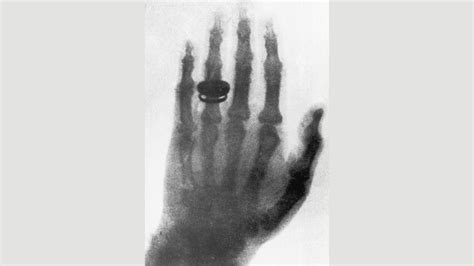 The secret history of X-ray specs - BBC Future