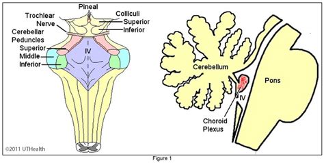 Neuroanatomy Online: Lab 8 - Higher Motor Function - Gross Anatomy ...