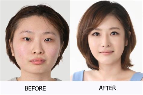 All About Korean Plastic Surgery | Cirugía plástica coreana, Maquillaje antes y después ...