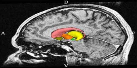 Subthalamic Nucleus - Assignment Point