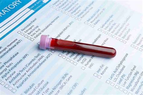 What are your blood test results telling you? - Calcium