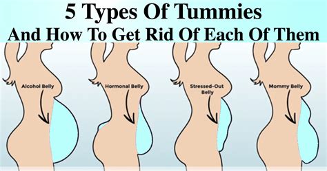 5 Types Of Tummies And How To Get Rid Of Them