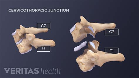 Cervical Vertebrae