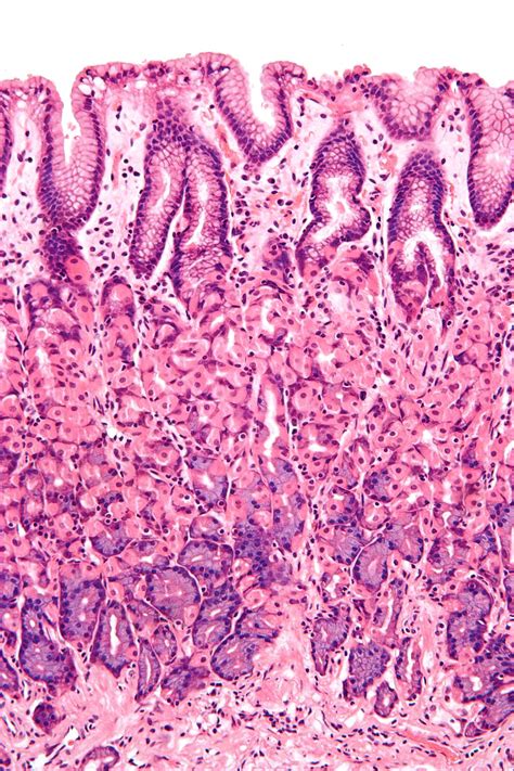 Simple columnar epithelium - Wikipedia